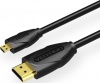 Фото товара Кабель HDMI -> microHDMI Vention 4K 3 м Black (VAA-D03-B300)